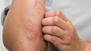 ô nhiễm nguồn nước là gìô nhiễm nguồn nước là gì